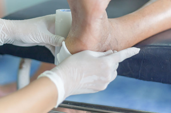 NY Foot   Ankle Specialists | Corns   Calluses, Hammertoes and Diabetic Foot Care
